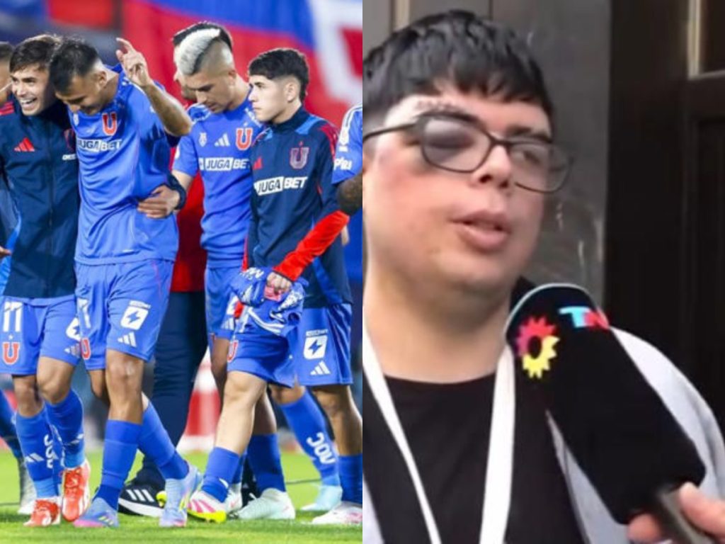 🟠 ¡Hincha brutalmente golpeado en Argentina necesita ayuda! Figura de Universidad de Chile hizo un aporte 9 🟠 ¡Hincha brutalmente golpeado en Argentina necesita ayuda! Figura de Universidad de Chile hizo un aporte