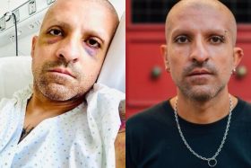 ¿Qué fue lo que dijo? Rodrigo Rojas Vade despierta del coma inducido y habla con la PDI