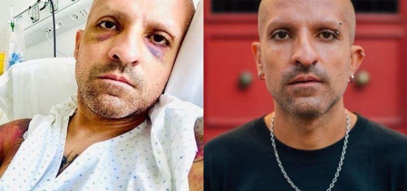 ¿Qué fue lo que dijo? Rodrigo Rojas Vade despierta del coma inducido y habla con la PDI